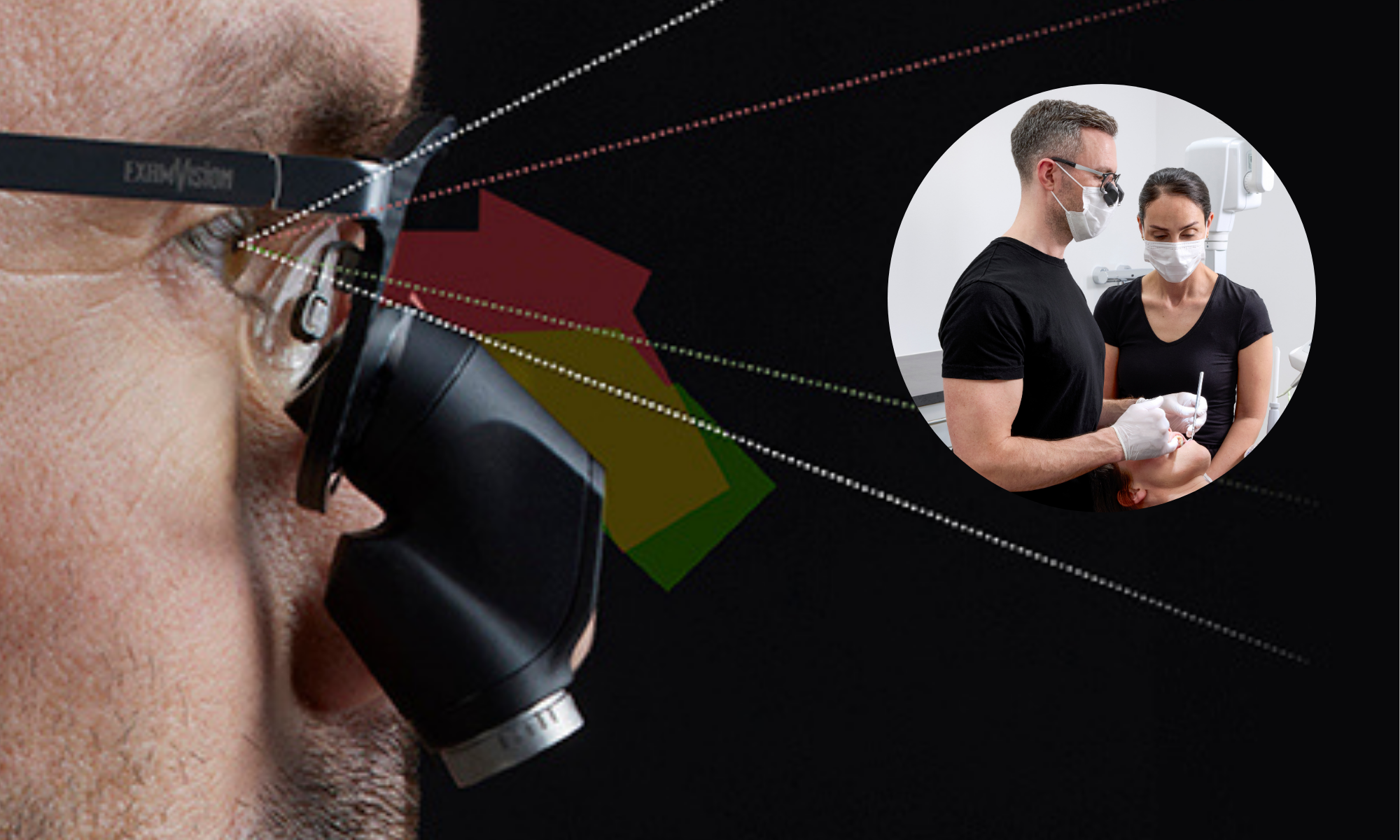 Kepler Reflekt: el porqué todas las lupas ergo no son iguales.