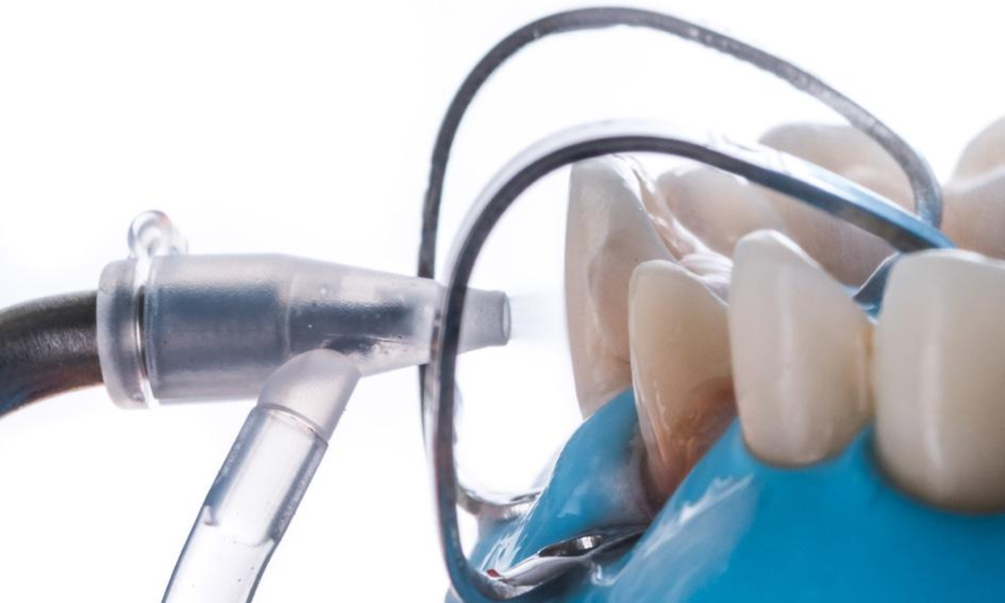 Adhesión y AquaCare: cómo optimizar los resultados en odontología restauradora