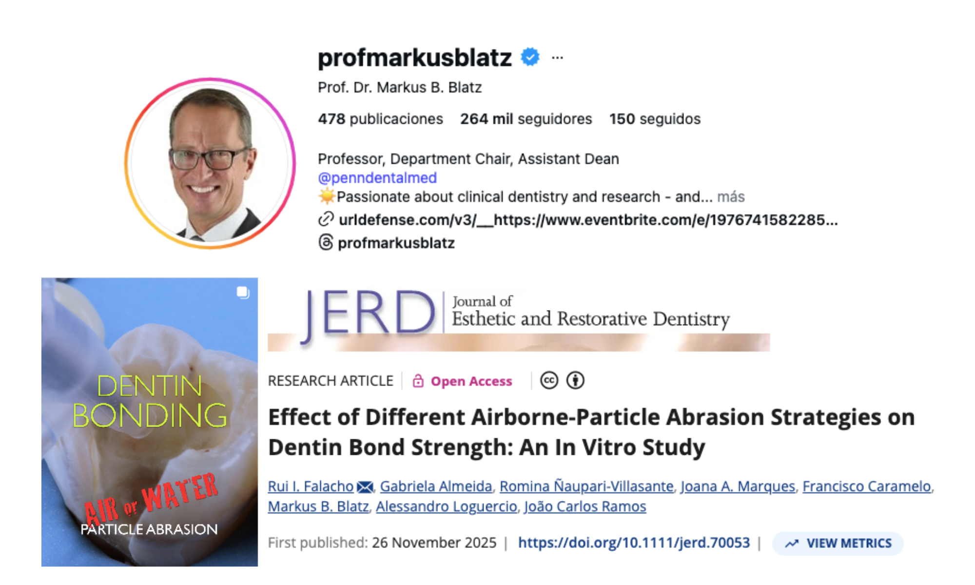 Nuevo artículo: adhesión en dentina