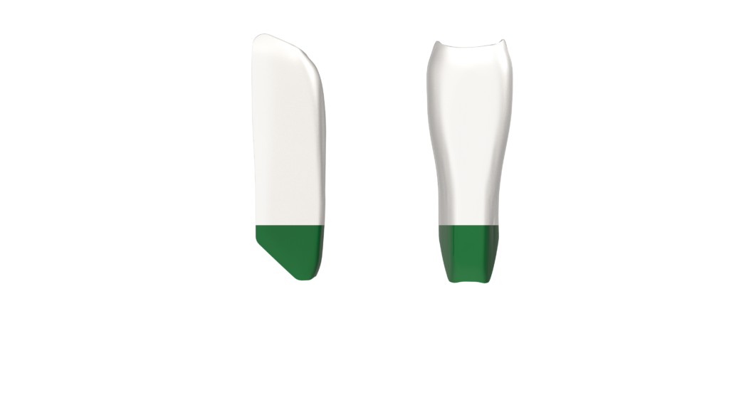 Black Triangle (BT) Anterior Kit
