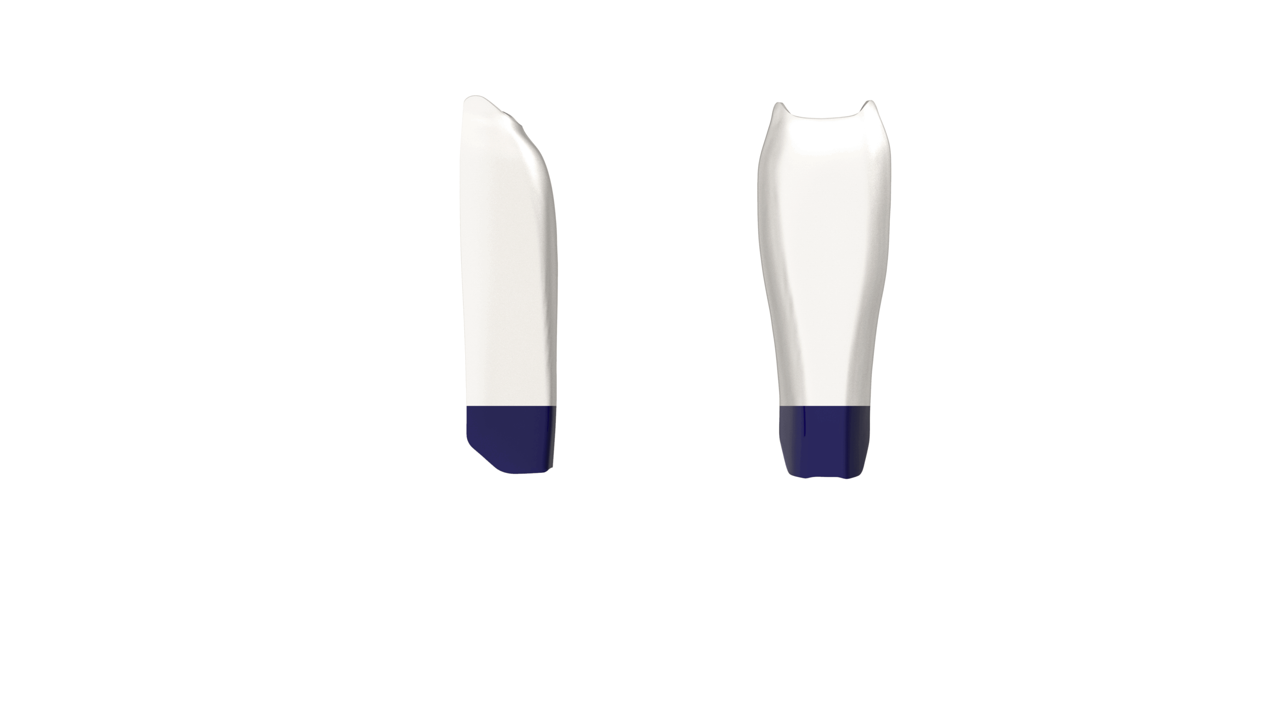 Black Triangle (BT) Anterior Kit